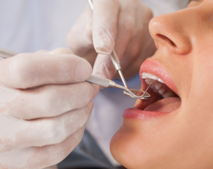Periodoncia